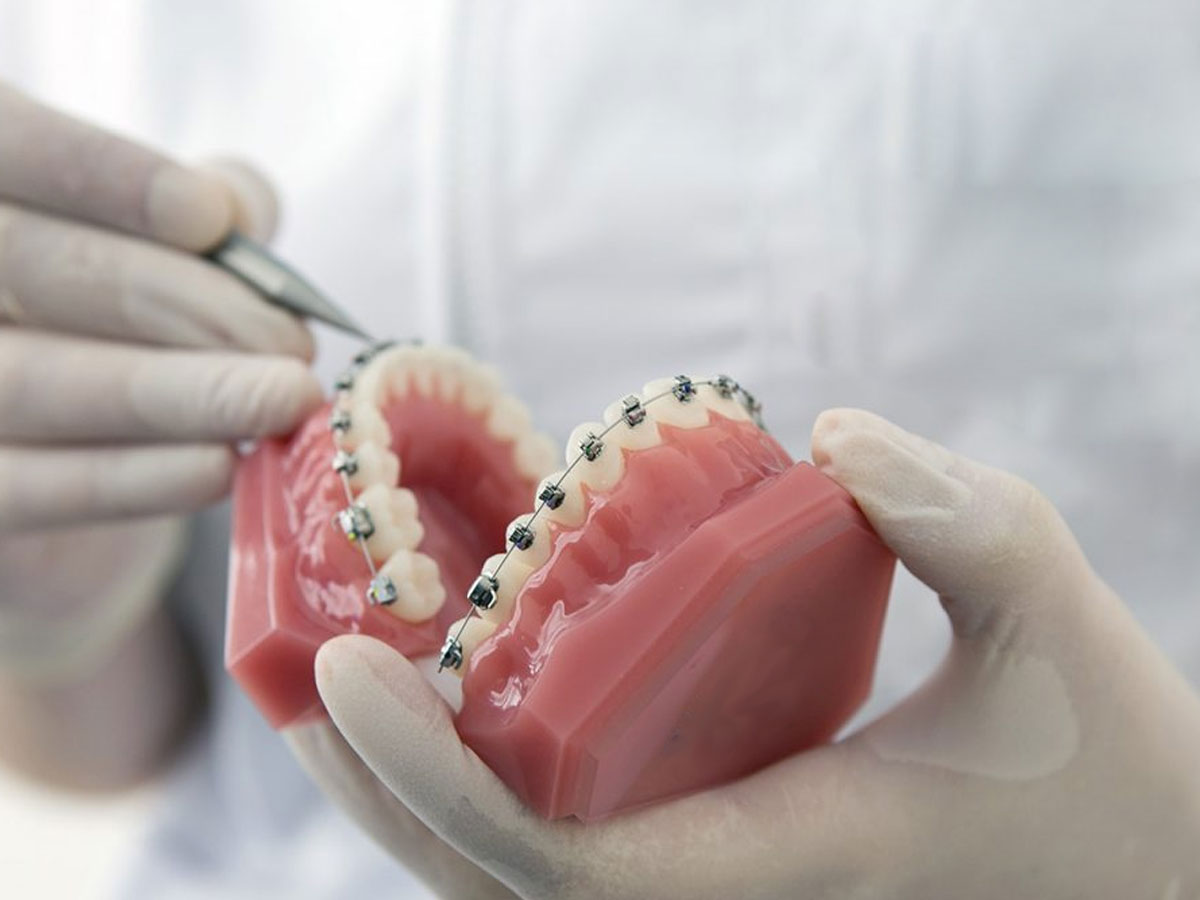 Todos los ortodoncistas son dentistas, pero no todos los dentistas son ortodoncistas