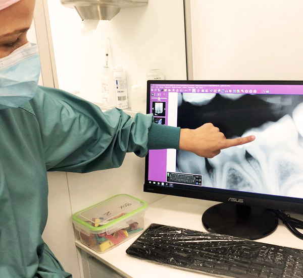 Radiografía Infantil | Ustrell & García Clínica Dental 