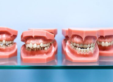 ¿Cómo saber si necesito ortodoncia?