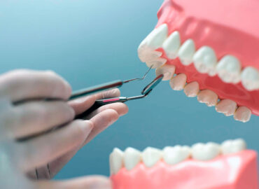 Tipos de mordida en ortodoncia