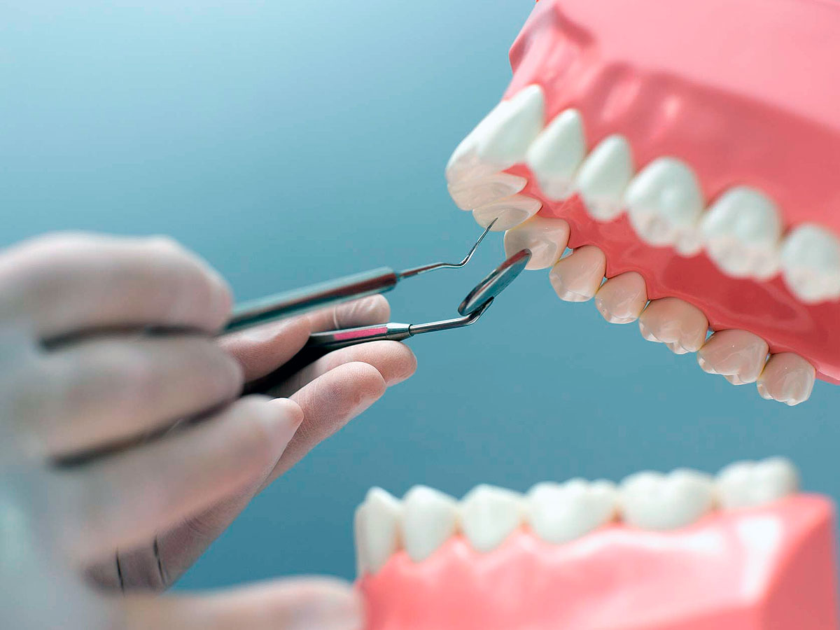 Tipos de mordida en ortodoncia