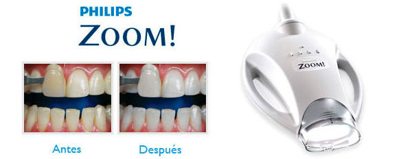 Antes y Después Blanqueamiento dental profesional con Zoom WhiteSpeed | Ustrell&García Clínica Dental